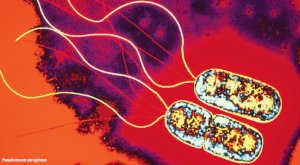 Pseudomonas aeruginosa (Courtesy of Insights magazine, 6 MARCH 2015 • VOL 347 ISSUE 6226 via PHOTO- LINDA M. STANNARD:UNIVERSITY OF CAPE TOWN:SCIENCE SOURCE:PHOTO RESEARCHERS; ILLUSTRATION- C. SMITH:SCIENCE )